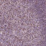 BTLA Antibody in Immunohistochemistry (Paraffin) (IHC (P))