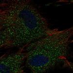 RC3H2 Antibody in Immunocytochemistry (ICC/IF)