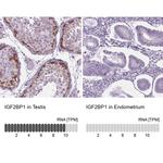 IGF2BP1 Antibody