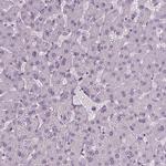 IGF2BP1 Antibody in Immunohistochemistry (Paraffin) (IHC (P))