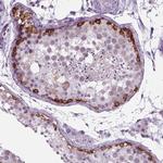 IGF2BP1 Antibody in Immunohistochemistry (Paraffin) (IHC (P))