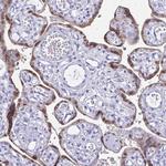 HMGB3 Antibody in Immunohistochemistry (Paraffin) (IHC (P))