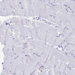 HMGB3 Antibody in Immunohistochemistry (Paraffin) (IHC (P))