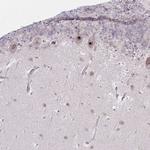 NUP85 Antibody in Immunohistochemistry (Paraffin) (IHC (P))