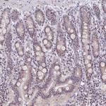 NUP85 Antibody in Immunohistochemistry (Paraffin) (IHC (P))