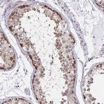 NUP85 Antibody in Immunohistochemistry (Paraffin) (IHC (P))