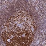 DCK Antibody in Immunohistochemistry (Paraffin) (IHC (P))