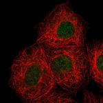 DOK7 Antibody in Immunocytochemistry (ICC/IF)