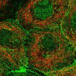 PKP3 Antibody in Immunocytochemistry (ICC/IF)