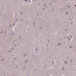 PKP3 Antibody in Immunohistochemistry (Paraffin) (IHC (P))