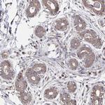 Acetyl-CoA Carboxylase Antibody in Immunohistochemistry (Paraffin) (IHC (P))