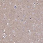 Acetyl-CoA Carboxylase Antibody in Immunohistochemistry (Paraffin) (IHC (P))