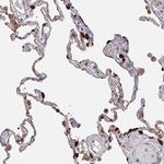 Acetyl-CoA Carboxylase Antibody in Immunohistochemistry (Paraffin) (IHC (P))