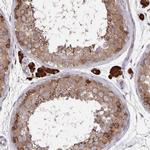 Acetyl-CoA Carboxylase Antibody in Immunohistochemistry (Paraffin) (IHC (P))