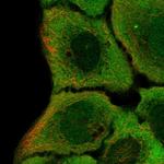 IRF6 Antibody in Immunocytochemistry (ICC/IF)