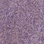 IRF6 Antibody in Immunohistochemistry (Paraffin) (IHC (P))