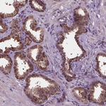 IRF6 Antibody in Immunohistochemistry (Paraffin) (IHC (P))