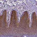 IRF6 Antibody in Immunohistochemistry (Paraffin) (IHC (P))