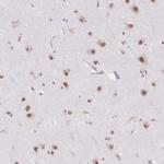 DDX17 Antibody in Immunohistochemistry (Paraffin) (IHC (P))