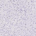 DDX17 Antibody in Immunohistochemistry (Paraffin) (IHC (P))