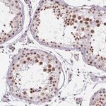 DDX17 Antibody in Immunohistochemistry (Paraffin) (IHC (P))