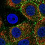 Epsin 3 Antibody in Immunocytochemistry (ICC/IF)