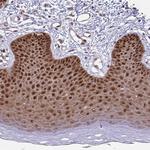 HSP40 Antibody in Immunohistochemistry (Paraffin) (IHC (P))