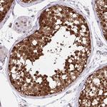 HSP40 Antibody in Immunohistochemistry (Paraffin) (IHC (P))