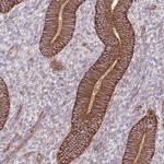 ITGA2 Antibody in Immunohistochemistry (Paraffin) (IHC (P))