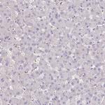 ITGA2 Antibody in Immunohistochemistry (Paraffin) (IHC (P))