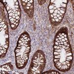 ITGA2 Antibody in Immunohistochemistry (Paraffin) (IHC (P))