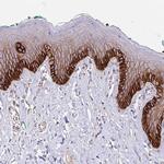 ITGA2 Antibody in Immunohistochemistry (Paraffin) (IHC (P))