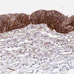 ITGA2 Antibody in Immunohistochemistry (Paraffin) (IHC (P))