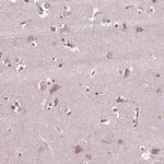 CPT1C Antibody in Immunohistochemistry (Paraffin) (IHC (P))