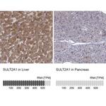 SULT2A1 Antibody