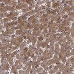 SULT2A1 Antibody in Immunohistochemistry (Paraffin) (IHC (P))