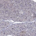 SULT2A1 Antibody in Immunohistochemistry (Paraffin) (IHC (P))