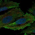 HCK Antibody in Immunocytochemistry (ICC/IF)