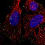 Vinculin Antibody in Immunocytochemistry (ICC/IF)