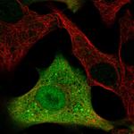 ALDH3A1 Antibody in Immunocytochemistry (ICC/IF)