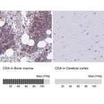 CDA Antibody