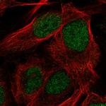 CDA Antibody in Immunocytochemistry (ICC/IF)