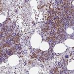 CDA Antibody in Immunohistochemistry (Paraffin) (IHC (P))