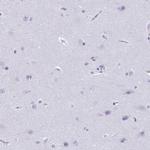 CDA Antibody in Immunohistochemistry (Paraffin) (IHC (P))