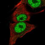 PIK3CB Antibody in Immunocytochemistry (ICC/IF)