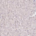 CENPF Antibody in Immunohistochemistry (Paraffin) (IHC (P))