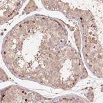 CENPF Antibody in Immunohistochemistry (Paraffin) (IHC (P))