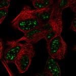 ATXN7L3 Antibody in Immunocytochemistry (ICC/IF)