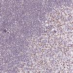 Oct-2 Antibody in Immunohistochemistry (Paraffin) (IHC (P))