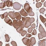 SEC14L2 Antibody in Immunohistochemistry (Paraffin) (IHC (P))